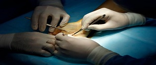 Hand Surgery1