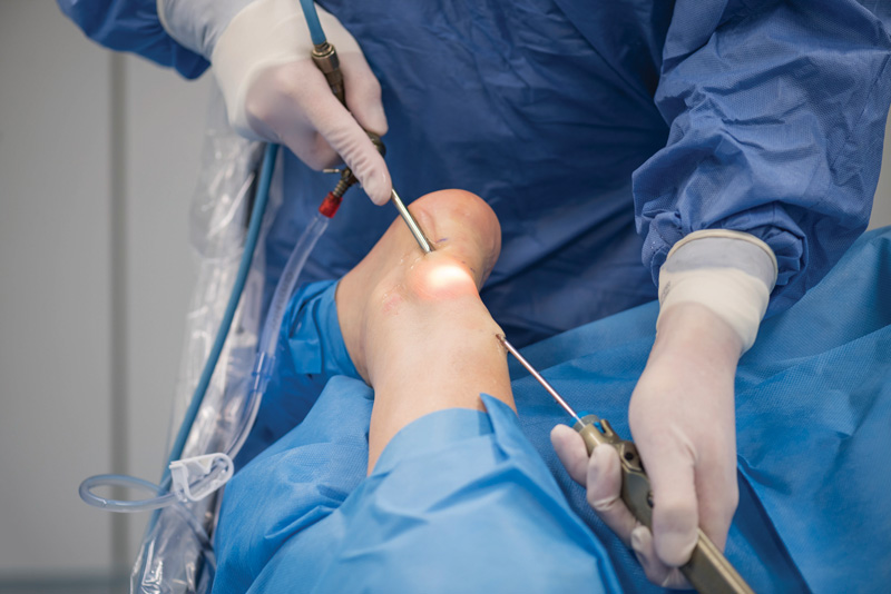 foot ankle surgery 1